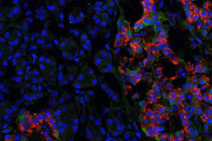 tested_insulin_antibodies